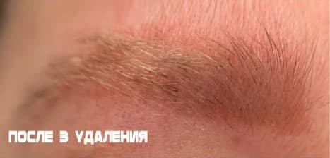 После удаления